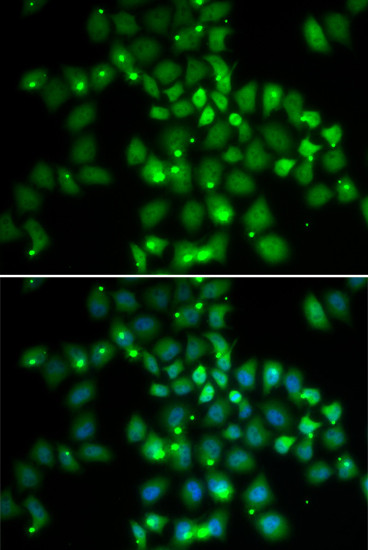 PCGF6 Antibody in Immunocytochemistry (ICC/IF)