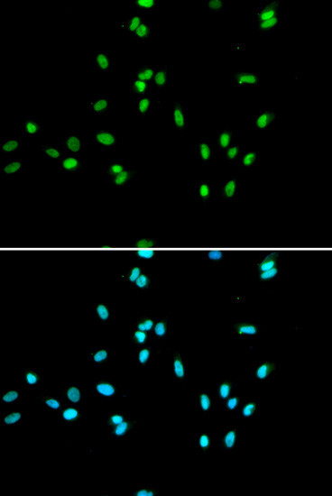 NR5A2 Antibody in Immunocytochemistry (ICC/IF)