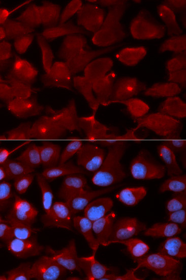 SMARCB1 Antibody in Immunocytochemistry (ICC/IF)