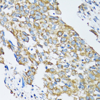 SLC25A13 Antibody in Immunohistochemistry (Paraffin) (IHC (P))