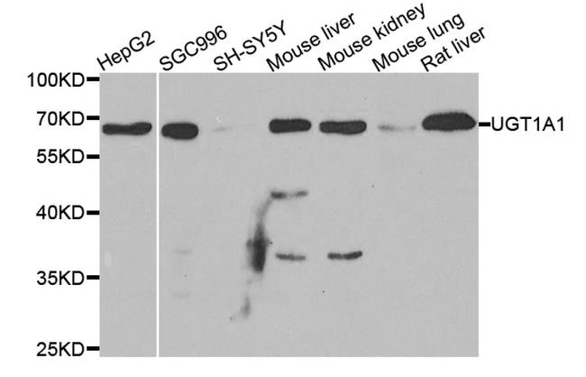 UGT1A1 Antibody in Western Blot (WB)