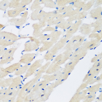 Pleckstrin Antibody in Immunohistochemistry (Paraffin) (IHC (P))