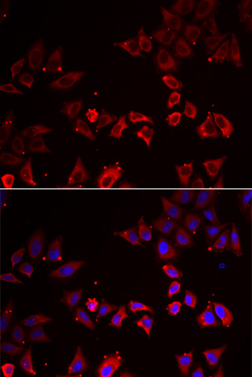 LIMS1 Antibody in Immunocytochemistry (ICC/IF)