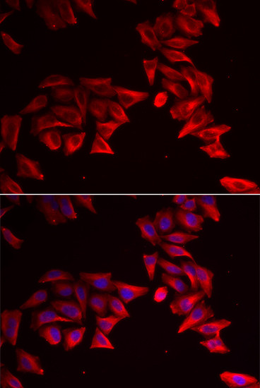 SFRP4 Antibody in Immunocytochemistry (ICC/IF)