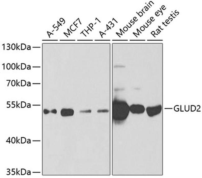 GluD2 Antibody in Western Blot (WB)