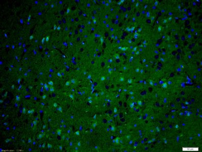 KIF1B Antibody in Immunohistochemistry (Paraffin) (IHC (P))