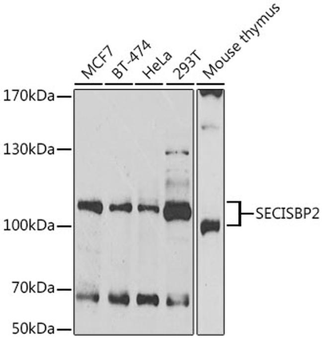 SBP2 Antibody in Western Blot (WB)