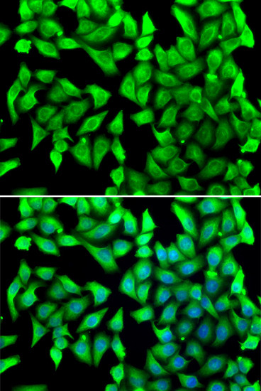 VTI1B Antibody in Immunocytochemistry (ICC/IF)