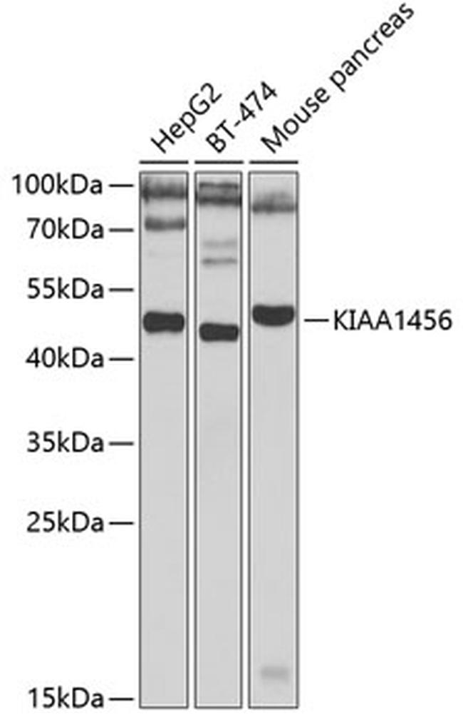 KIAA1456 Antibody in Western Blot (WB)