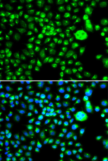 SMCHD1 Antibody in Immunocytochemistry (ICC/IF)