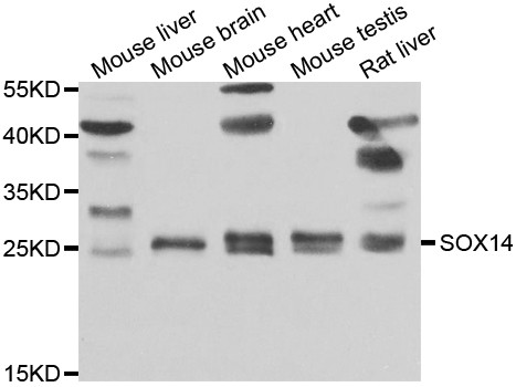 SOX14 Antibody in Western Blot (WB)