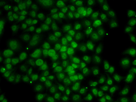 ATMIN Antibody in Immunocytochemistry (ICC/IF)