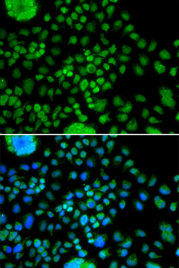 ATOH7 Antibody in Immunocytochemistry (ICC/IF)