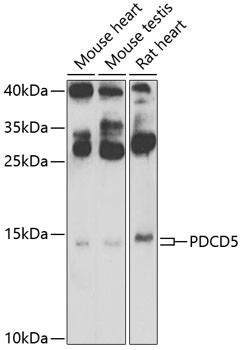 PDCD5 Antibody in Immunocytochemistry (ICC/IF)