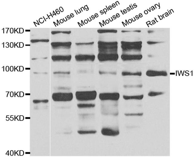 IWS1 Antibody in Western Blot (WB)