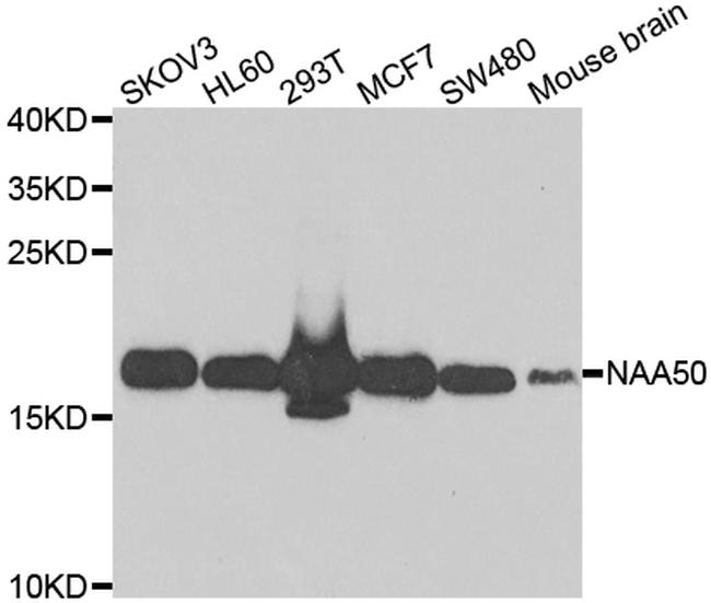 NAT13 Antibody in Western Blot (WB)