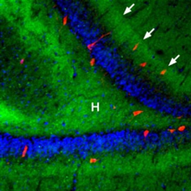 beta-3 Adrenergic Receptor (extracellular) Antibody in Immunohistochemistry (IHC)