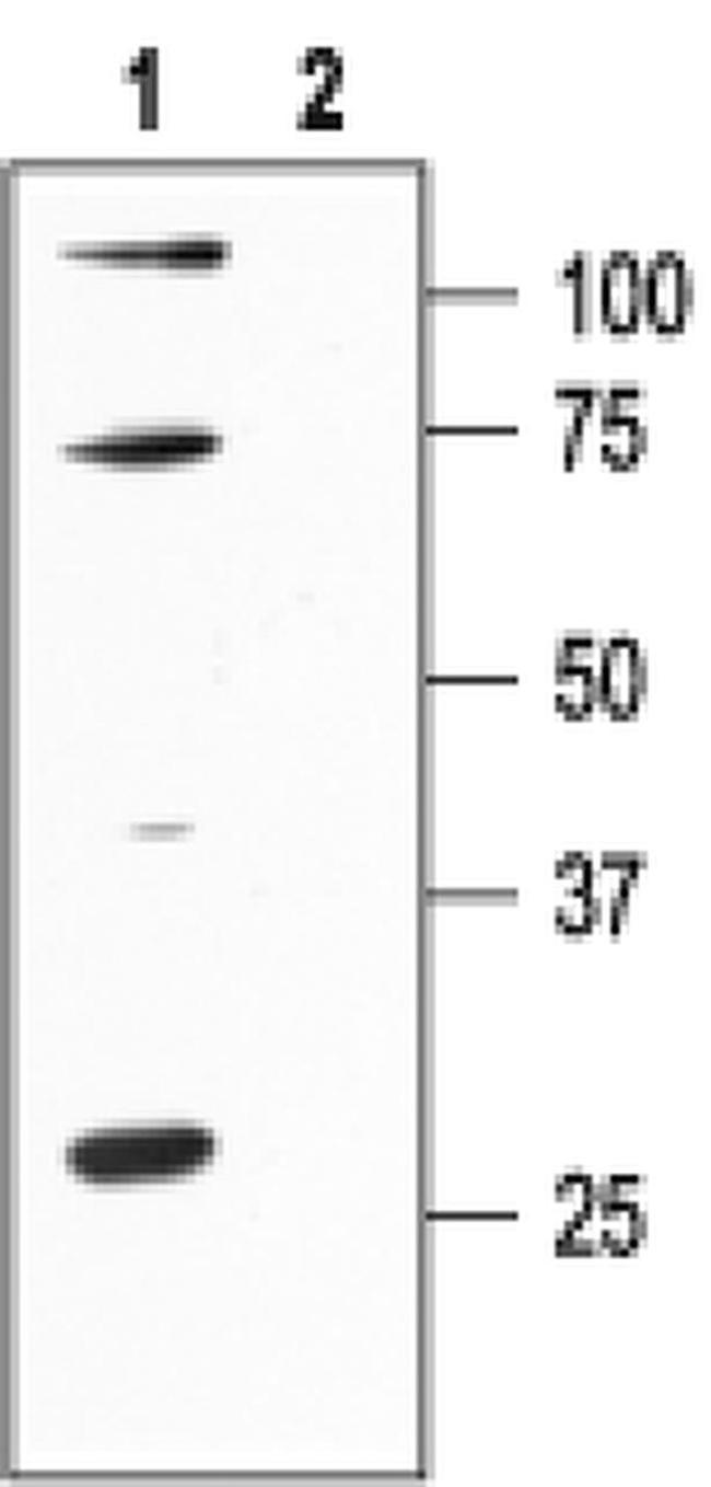 KCNN1 Antibody in Western Blot (WB)