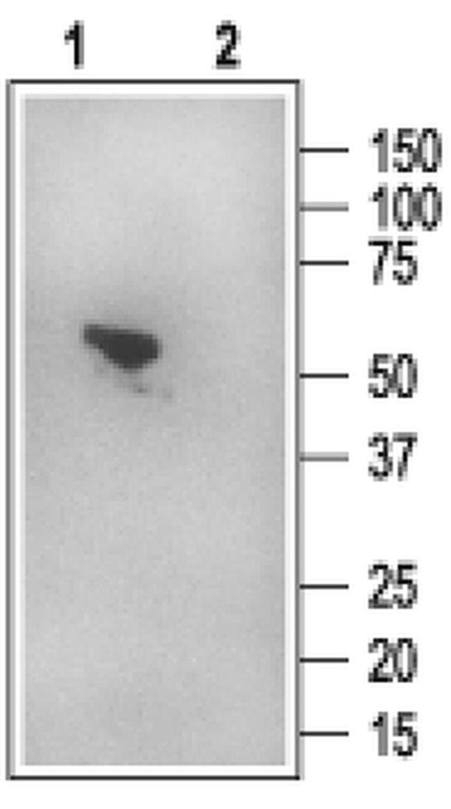 EBP50 Antibody in Western Blot (WB)