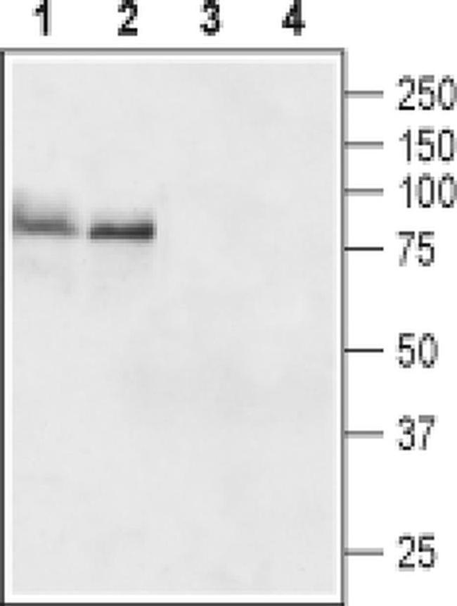 TSH Receptor (extracellular) Antibody in Western Blot (WB)