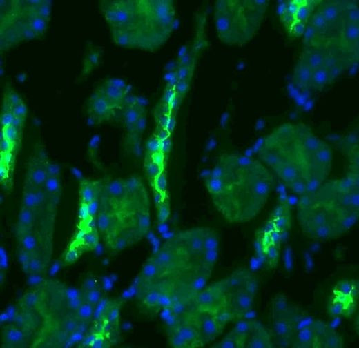 SLC12A3 Antibody in Immunohistochemistry (IHC)