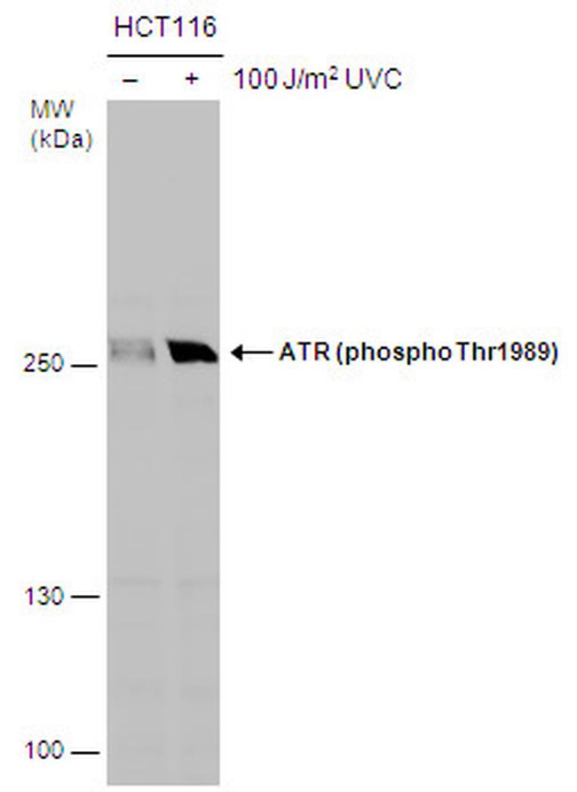 Phospho-ATR (Thr1989) Antibody in Western Blot (WB)