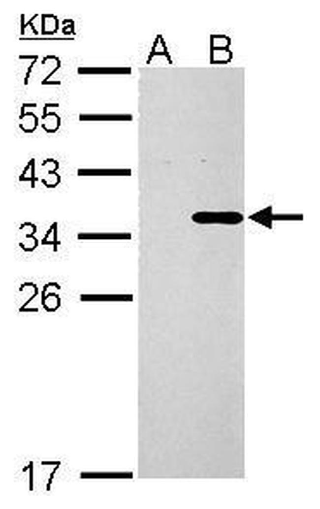 COL11A2 Antibody in Western Blot (WB)