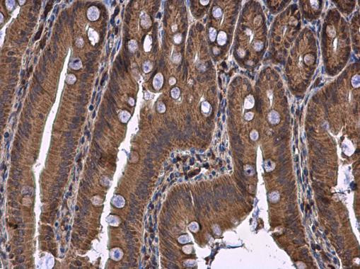 DHCR7 Antibody in Immunohistochemistry (Paraffin) (IHC (P))