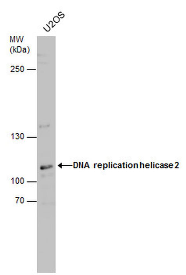 DNA2 Antibody in Western Blot (WB)