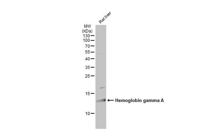 Hemoglobin gamma A Antibody in Western Blot (WB)