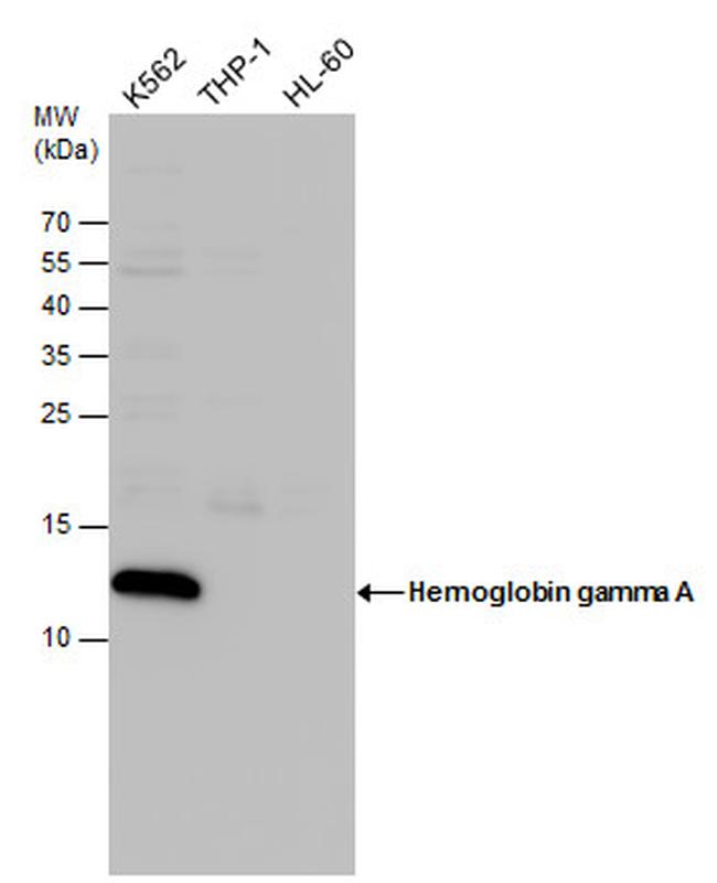 Hemoglobin gamma A Antibody in Western Blot (WB)