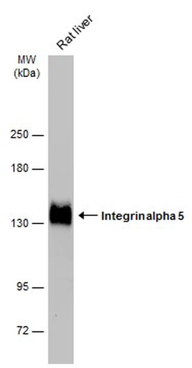 ITGA5 Antibody in Western Blot (WB)