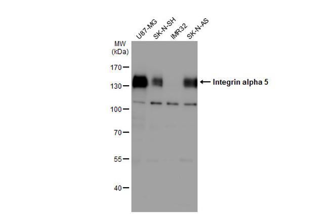 ITGA5 Antibody in Western Blot (WB)