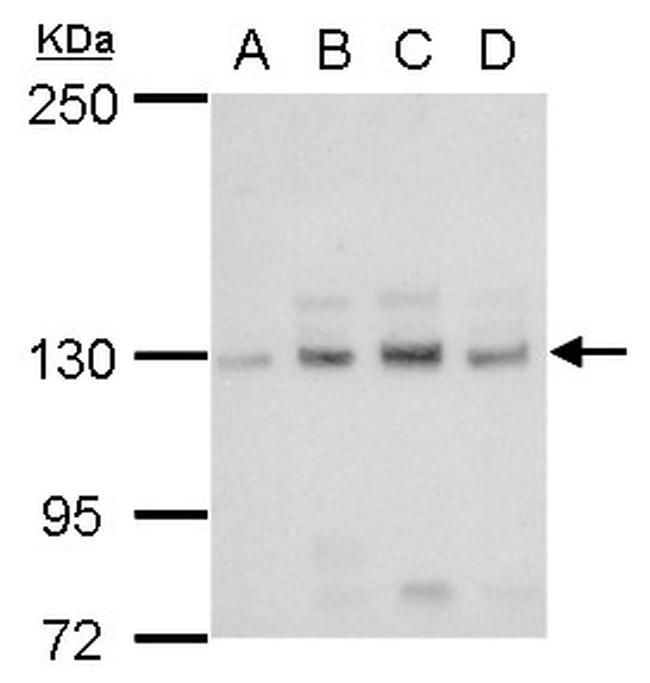 CD171 (L1CAM) Antibody in Western Blot (WB)