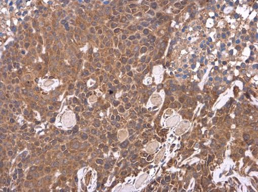 LIPC Antibody in Immunohistochemistry (Paraffin) (IHC (P))