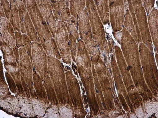 ME2 Antibody in Immunohistochemistry (Paraffin) (IHC (P))