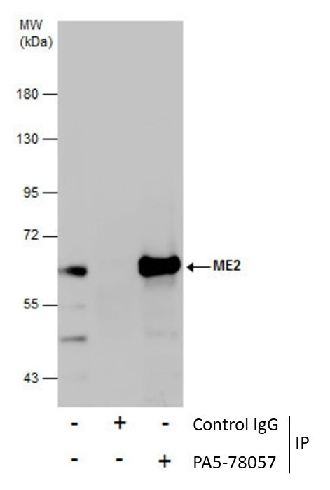 ME2 Antibody in Immunoprecipitation (IP)