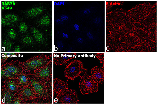 RAB7A Antibody in Immunocytochemistry (ICC/IF)