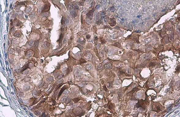 FADD Antibody in Immunohistochemistry (Paraffin) (IHC (P))