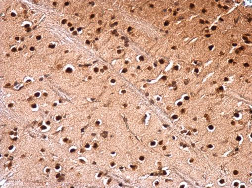 NUDT21 Antibody in Immunohistochemistry (Paraffin) (IHC (P))