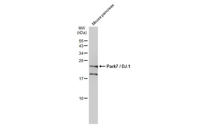 DJ-1 Antibody in Western Blot (WB)