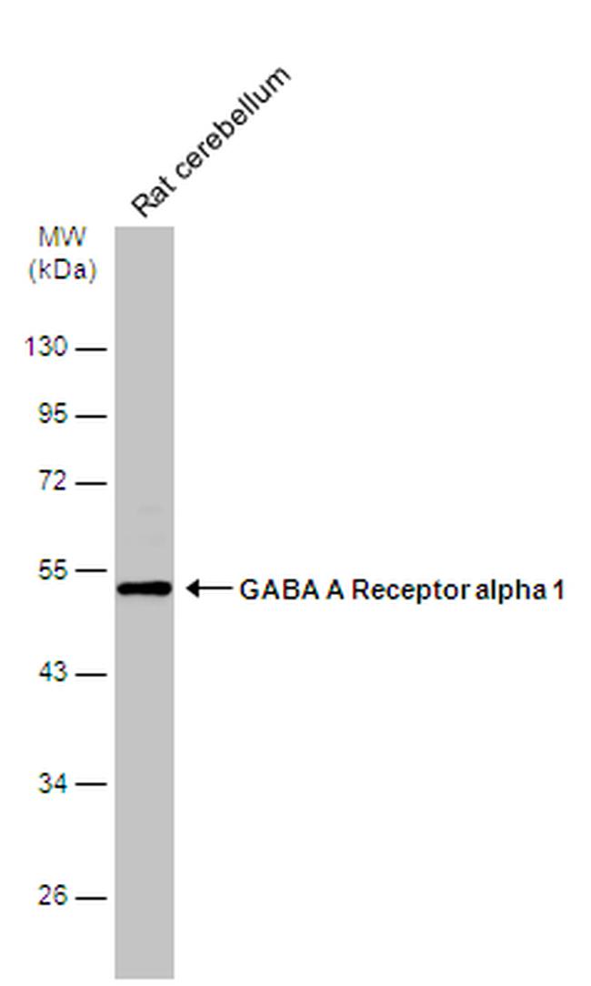 GABRA1 Antibody in Western Blot (WB)