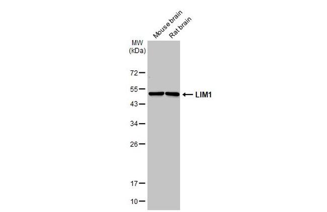 LIM1 Antibody in Western Blot (WB)