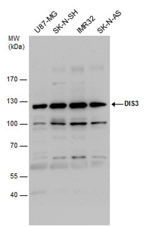 DIS3 Antibody in Western Blot (WB)
