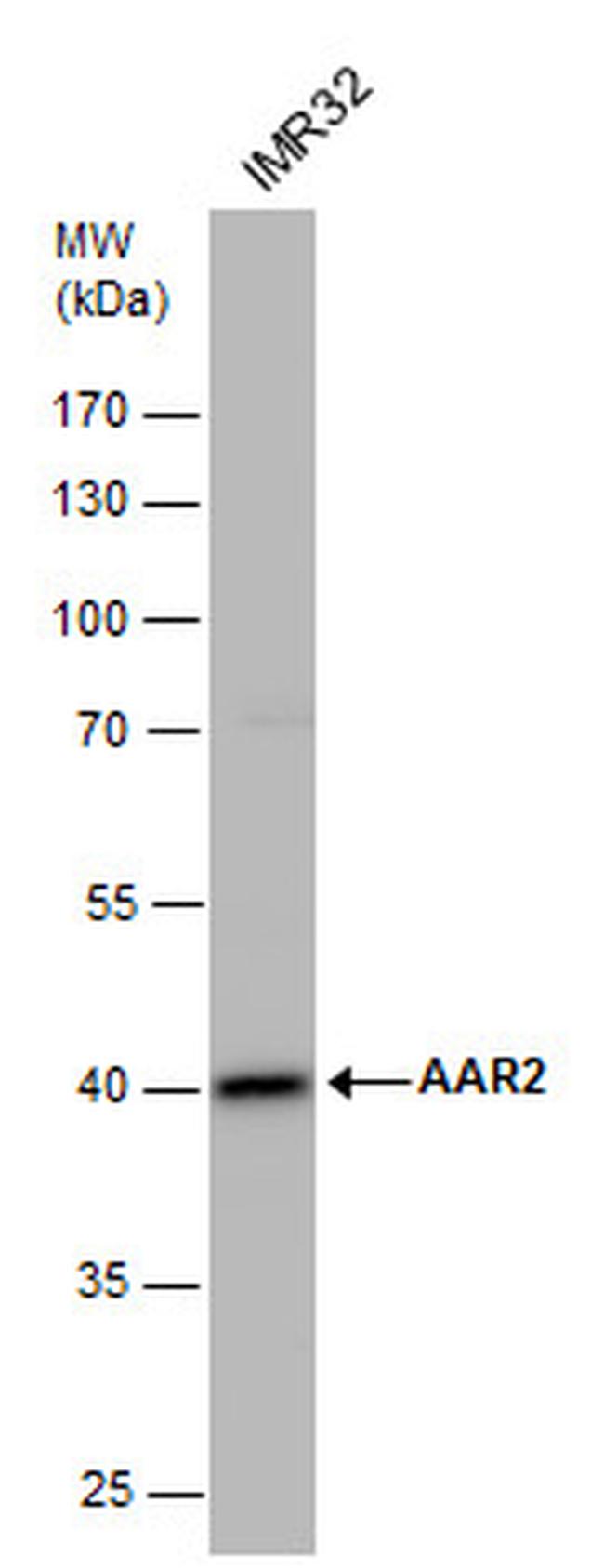 AAR2 Antibody in Western Blot (WB)