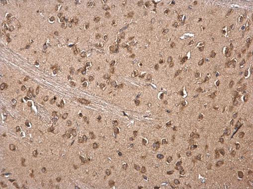 LSM14A Antibody in Immunohistochemistry (Paraffin) (IHC (P))