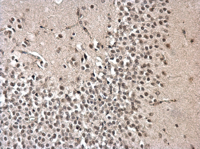 PRPF31 Antibody in Immunohistochemistry (Paraffin) (IHC (P))