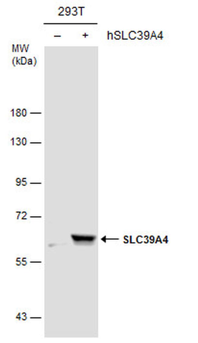 SLC39A4 Antibody in Western Blot (WB)
