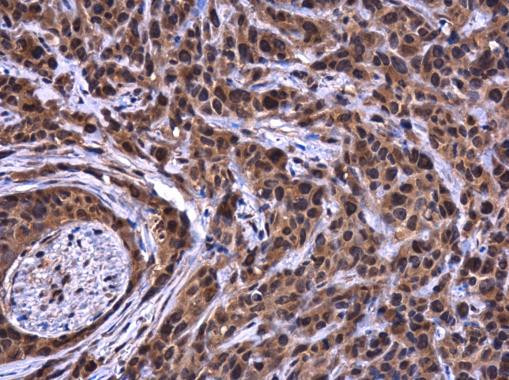 ATG101 Antibody in Immunohistochemistry (Paraffin) (IHC (P))