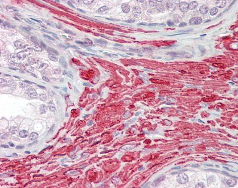 GREM2 Antibody in Immunohistochemistry (Paraffin) (IHC (P))